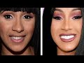 20 Celebrity Plastic Surgery Disasters