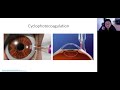 Your Guide to Glaucoma Surgery: What to Expect (Webinar)