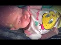 Baby Sleep Sounds, White Noise Lullaby for Babies, Colicky Baby, Crying Baby Calms and Sleep #020