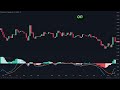 Most Effective MACD Strategy for Daytrading Crypto, Forex & Stocks (High Winrate Strategy)