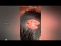 DIY Glitter Hairclip|Easy Glitter foam Sheet craft idea|Glitter hairclips|DIY Hair Accessories