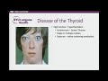 Thyroid Disorders and Cardiovascular Health