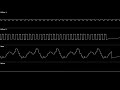 Dr. Mario (GB) - Chill | Oscilloscope view