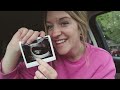FIRST TRIMESTER VLOG // symptoms, first appointments & early pregnancy anxiety