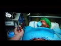 Surgeon Simulator - 'The Perfect Catch'