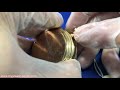 Removing Movements from Hunter Case Pocket Watches!  Decasing!