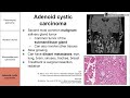 Salivary Gland Neoplasms