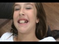 Orthodontist Appointment: Wire placement and changing of the ties