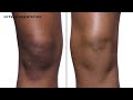 Dermablend Leg & Body Makeup With SPF 25 #You Tube Shorts # You tube # Best sellers #