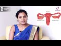 Irregular Periods & Pregnancy Chances - Causes | TIPS TO GET PREGNANT FAST- Dr. Manjula Deepak of C9