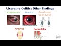Ulcerative Colitis Signs and Symptoms (& Why They Occur), and Complications