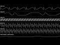 Sonic the Hedgehog 2 (Sega Genesis/Mega Drive) - Hill Top Zone | Oscilloscope view