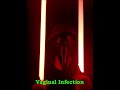 Slayerdude18   Vaginal Infection