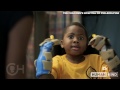 Little boy asked for prosthetics, ended up getting hands