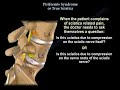 Piriformis syndrome  or disc herniation, how do you tell the difference ? a confusing presentation