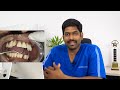 உங்கள் கேள்விகள் S1 E01 : Dentist answers viewer's questions in Tamil