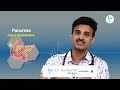 How to Treat Pancreatitis | Avoid Alcohol | Gallbladder Stones |Good Digestion |Dr.Ravikanth Kongara