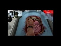Heart transplant success!! (surgeon simulator 2013 part 2)