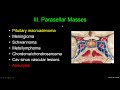 Sellar, Suprasellar and Parasellar Masses w/Dr. Shatzkes 7/21