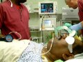 ~Tulip airway being inserted in an anaesthetised Patient