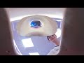 Going for an MRI Scan from a patient's perspective