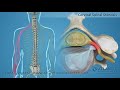 Endoscopic Anterior Cervical Discectomy