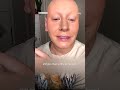 Watch the moment 10-year-old with alopecia goes out in public bald for 1st time