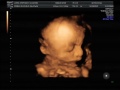 Baby Sophia 27W3D Ultrasound Part 1