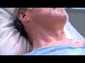 Examination of the jugular venous pulse / JVP examination Procedure video