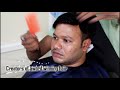 Non Surgical Hair Replacement in Hyderabad 9951223066