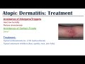 Eczema (Atopic Dermatitis) | Atopic Triad, Triggers, Who gets it, Why does it happen, & Treatment
