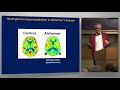Stephen Cunnane - Can Ketones Slow Down Alzheimer’s?