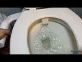 Veken Ultra-Slim Bidet, Dual Nozzle (Posterior/Feminine Wash) Adjustable Bidet #review  #bidet