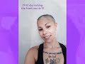 Timelapse of my 2 Year journey with Alopecia. From hair loss to hair growth.