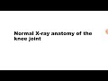 How to read knee joint X-ray in knee osteoarthritis | Normal Knee X ray | Ortho X ray interpretation
