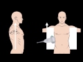 Basic Ultrasound Physics for EM