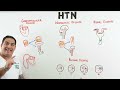 Hypertension | Clinical Medicine