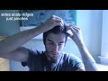 hair massage tutorial for hairloss