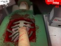 Surgeon simulator 2013 - I will never be a doctor