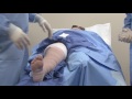 Great Saphenous Vein Ablation | For Patients