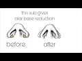 cherry reuploads alar base reduction subliminal