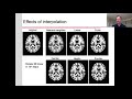 fMRI Analysis: Part 1 - Preprocessing