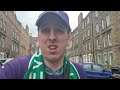 UTTER SHAMBLES HIBS | Hibernian 0-4 Aberdeen | The Hibs Vlog #25