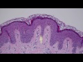 Normal Skin Histology - Explained by a Dermatopathologist