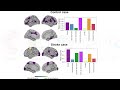 End-to-end Stroke imaging analysis, with reservoir computing #brain connectivity & interpretable #AI