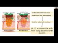 What is LP(a)? Does It Cause Heart Disease? #heartdisease #statins