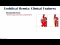 Umbilical Hernia | Belly Button Hernia | Risk Factors, Signs and Symptoms, Diagnosis, Treatment